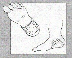 Ligasano 15x10x2cm n s13pz 2.1