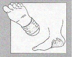 Ligasano 15x10x0,5 30cpr 2.1.7