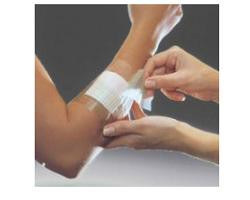 Opsite flexifix 5x1000 1med