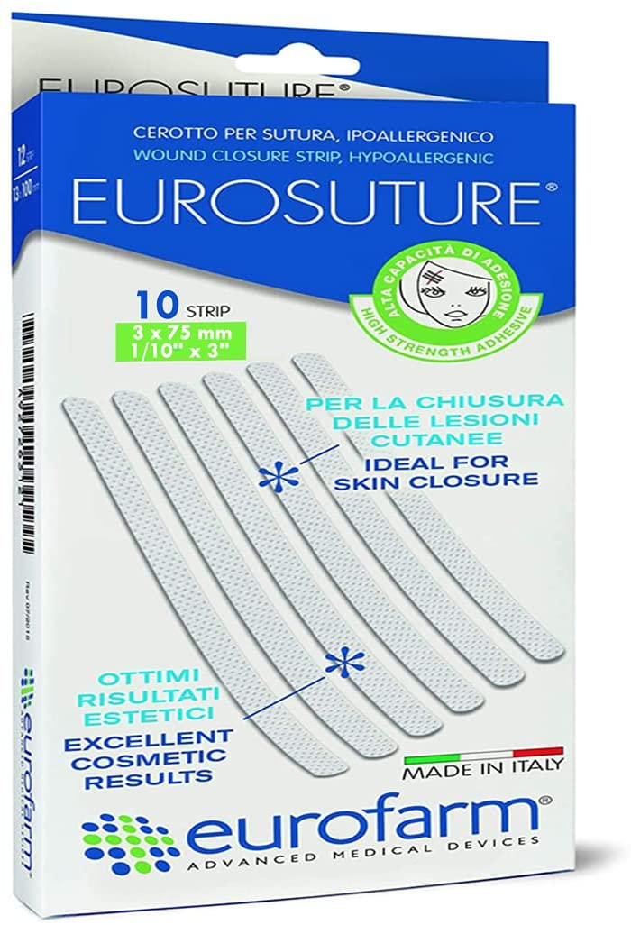 Cer eurosuture 3x75mm 10pz