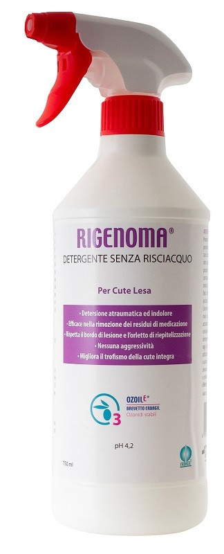 Rigenoma det s/risciacq