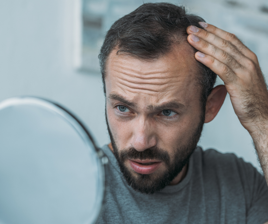caduta capelli uomo