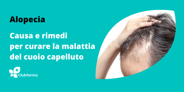Alopecia: cause e rimedi per curare la malattia del cuoio capelluto
